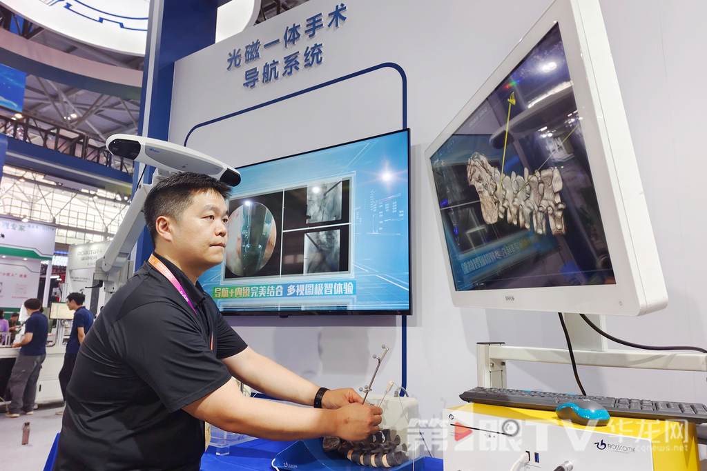 光磁一体手术导航系统。第1眼TV-华龙网记者 石涛 摄